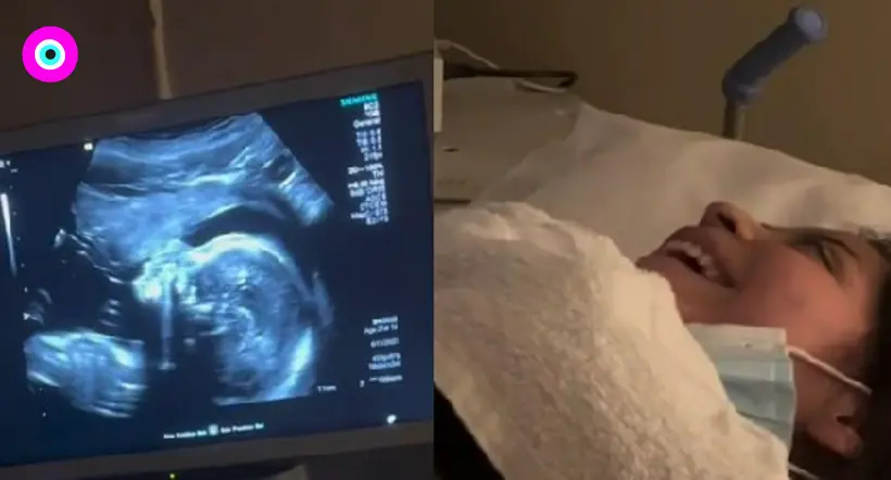 Video viral: madre canta en el ultra sonido y su bebé comienza a mover la boca