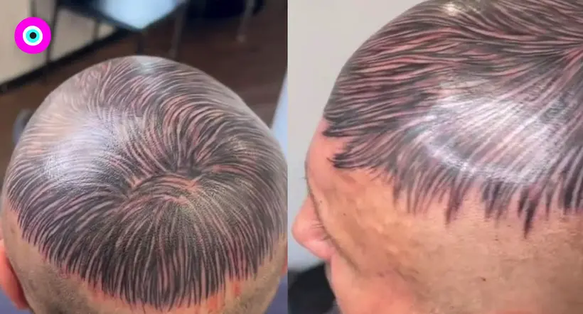 Video viral: hombre calvo se tatuó en la cabeza un peluquín