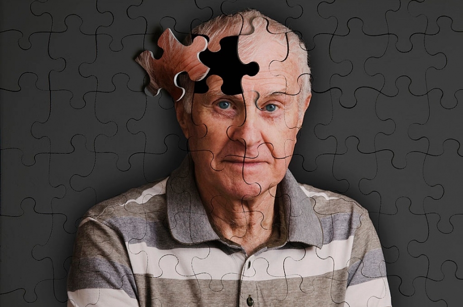 Alzheimer, imagen de referencia