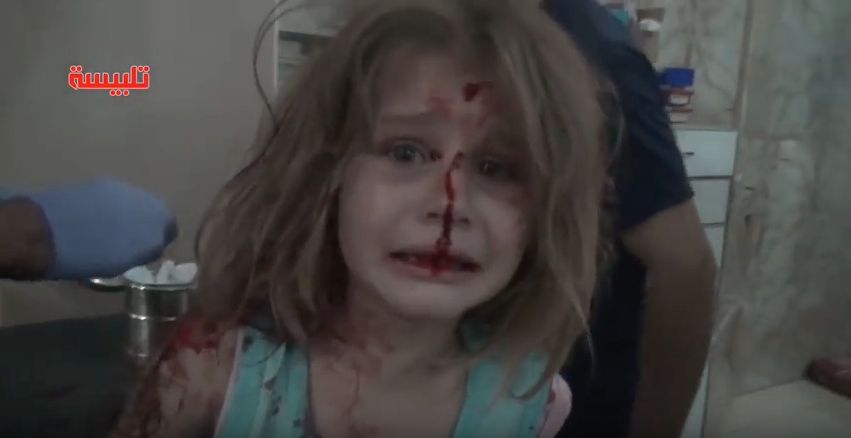 Niña siria herida tras bombardeo. Pulzo.com