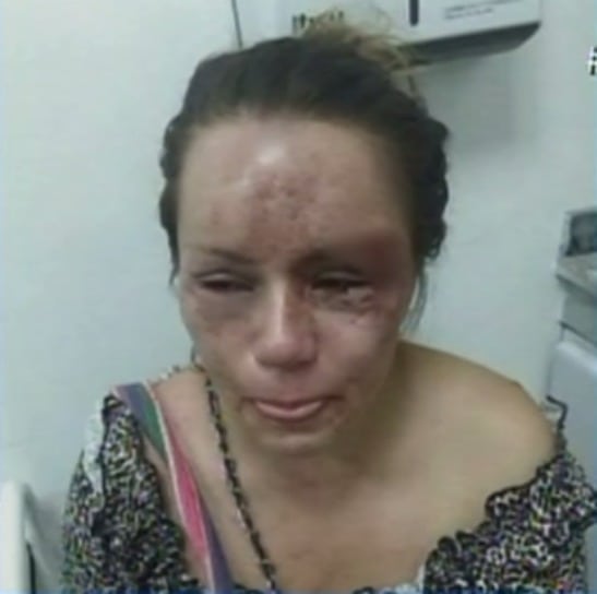 Jessica Viviana Góngora, mujer agredida por su pareja en Neiva. Pulzo.com