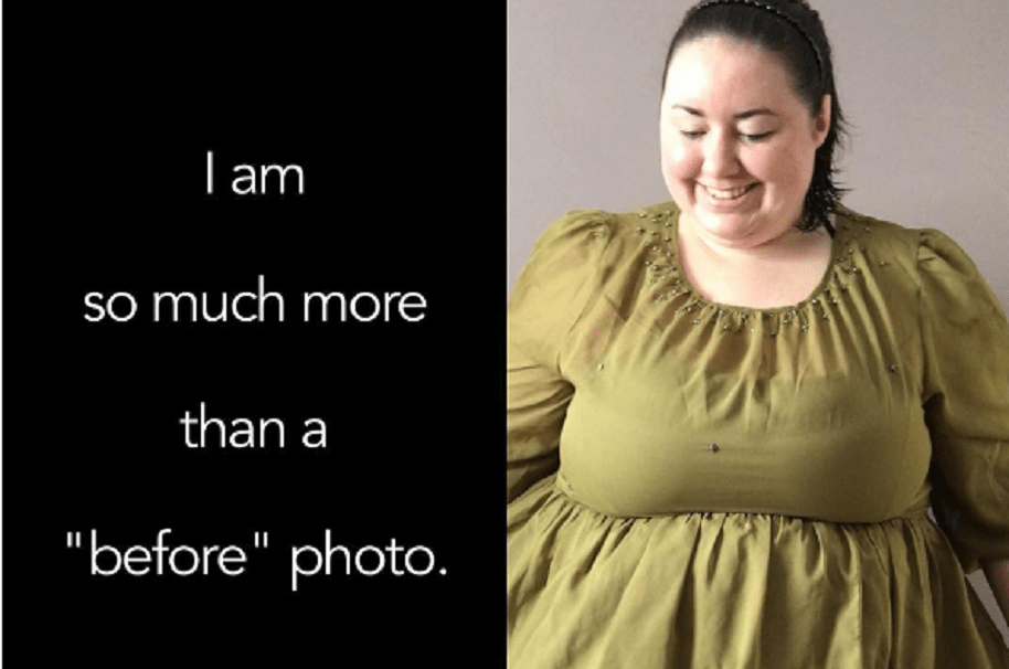 Campaña contra fotos antes y después