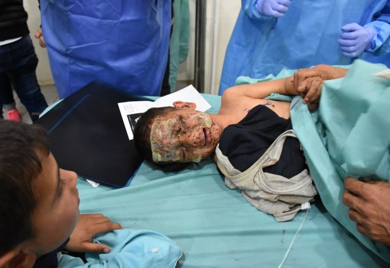 Niño sirio herido por explosión de carro bomba. Pulzo.com Niño sirio herido por explosión de carro bomba. Pulzo.com