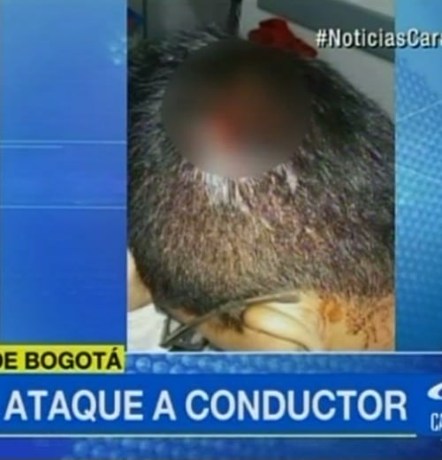 Presunto conductor de Uber atacado por taxistas en Bogotá.