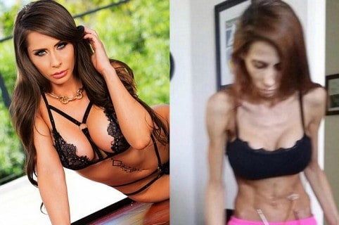 Actriz porno Madison Ivy comparte foto de recuperación tras accidente