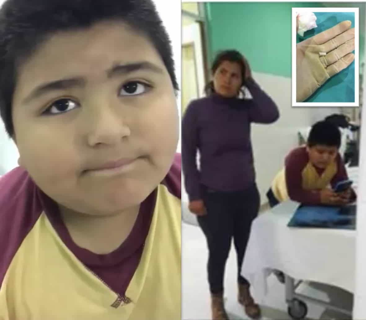 Niño se comió un pito