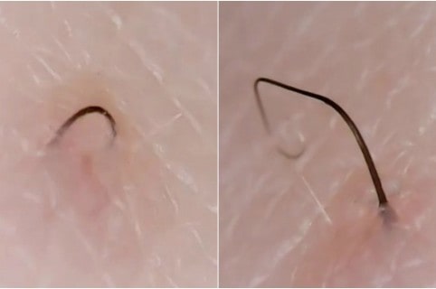 Cuenta de Instagram de vellos enterrados