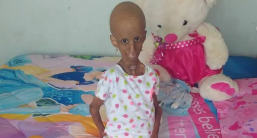 Magally González padecía progeria.