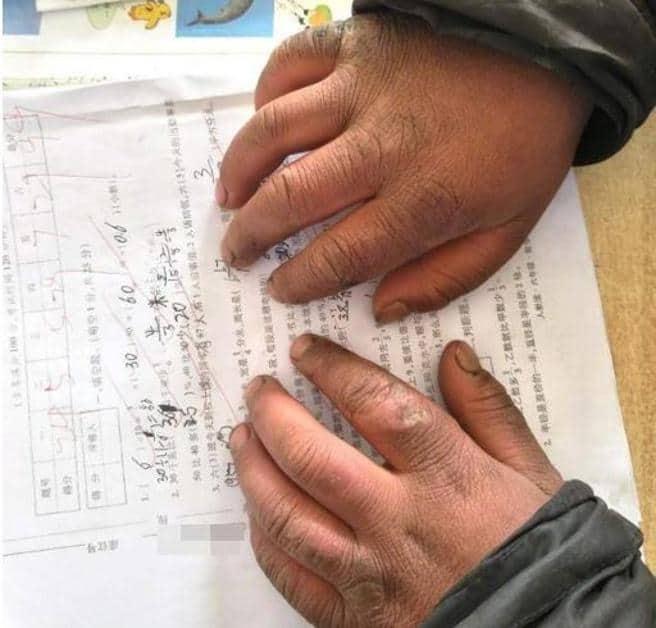 Manos congeladas Manos congeladas
