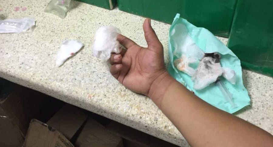 Patrullero herido