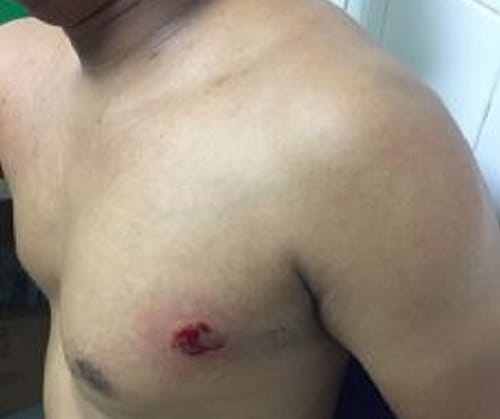 Patrullero herido