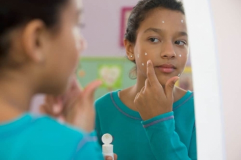 Resultado de imagen para crema dental acne