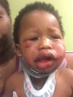 Bebé golpeado