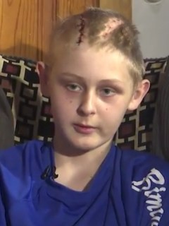 Niño con muerte cerebral