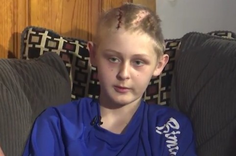 Niño con muerte cerebral