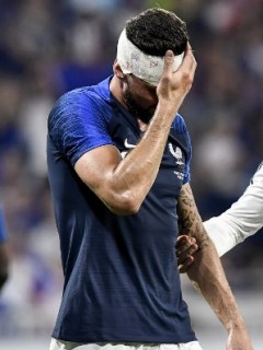 Olivier Giroud tras el choque con Matthew Miazga