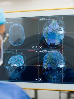Estudios del cerebro