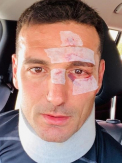 Lionel Scaloni