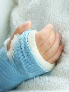 Niña con mano fracturada.