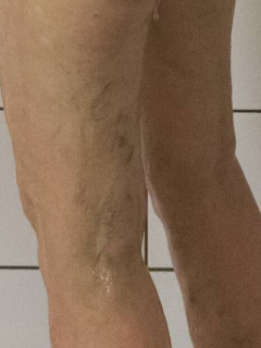 Piernas de mujer