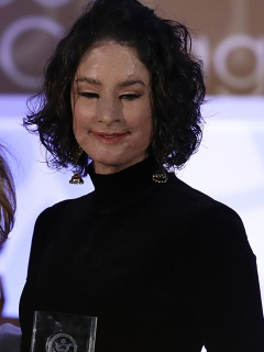 Natalia Ponce, víctima de ataque con ácido.