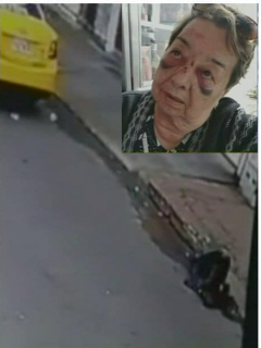 Taxista tumba a abuelita.