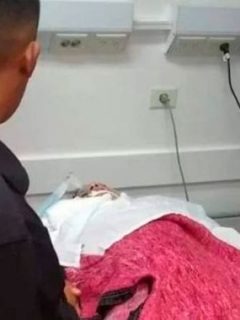 Mujer quemada