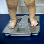 Piernas de niños obesos