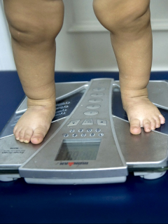 Piernas de niños obesos