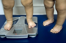 Piernas de niños obesos