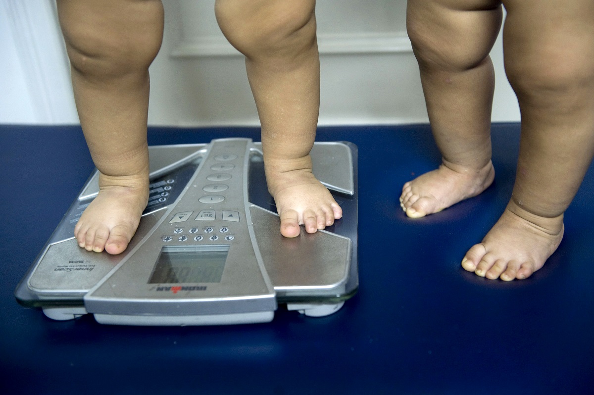 Piernas de niños obesos