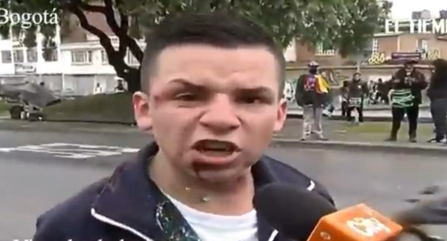 Estudiante al que le dispararon bala de goma