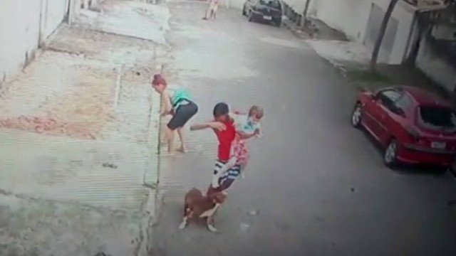 pitbull ataca a niño de 5 años