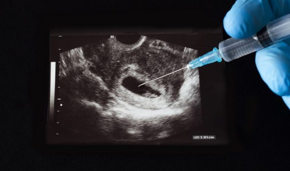 Aborto