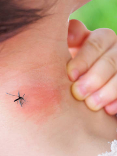 Dengue