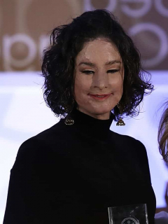 Natalia Ponce de León, víctima de ataque con ácido.