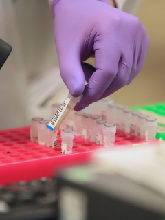 Pruebas de laboratorio de coronavirus