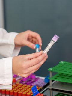 Casos de COVID-19, a punto de llegar a 1.000 en Bogotá.