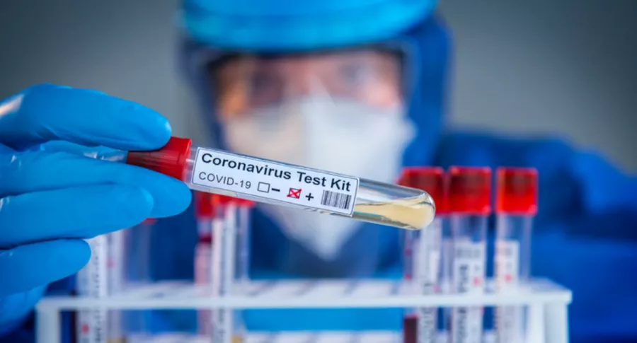Test de coronavirus