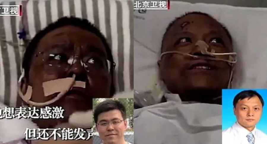 Médicos chinos que les cambió color de piel