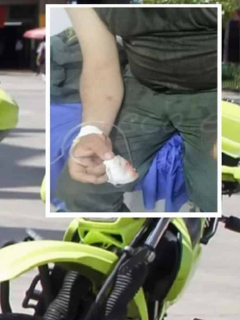 Policía pierde dedo por mordisco de hombre con el que peleaba