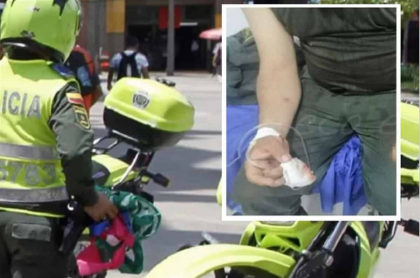 Policía pierde dedo por mordisco de hombre con el que peleaba