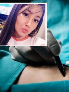 Cárcel a médico por muerte de joven en cirugía, en Bogotá