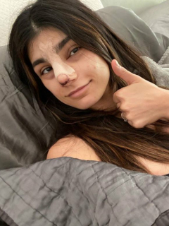 Mia Khalifa reveló cómo le quedó nariz, luego del retoque que se hizo para su boda