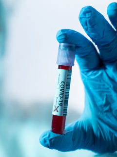 Imagen de una prueba positiva de coronavirus que ilustra nota sobre 4 colaboradores del Invías que dieron positivo para la enfermedad.