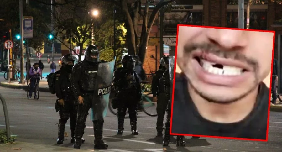 Imagen ilustrativa de las autoridades, a propósito de la denuncia de abuso policial de un joven al que le tumbaron los dientes. (Fotomontaje de Pulzo)