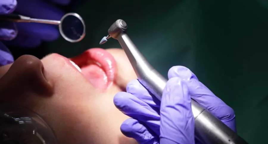 Imagen de una paciente en el dentista ilustra nota sobre un odontólogo al que enviaron a la cárcel por montar patineta mientras extraía un diente.