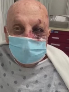 Eduardo Fernández, de 74 años, recibió una brutal golpiza en pleno metro de Miami.