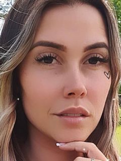 Selfi de Manuela Gómez, exprotagonista que perdió un diente por un mal diseño de sonrisa.