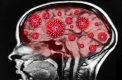 Imagen que ilustra cómo el coronavirus afecta al cerebro. 